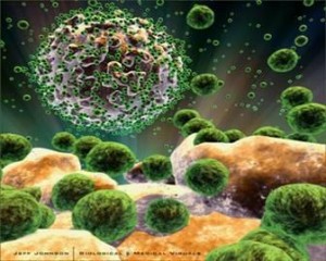 aids-hiv