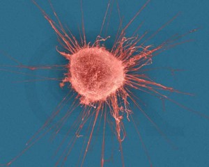 cancer-cell
