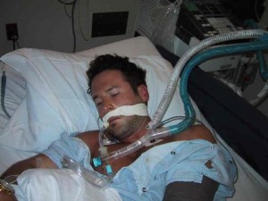 hyponatremia