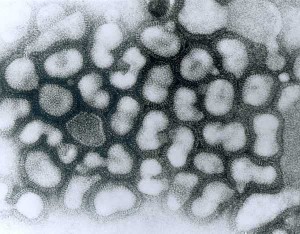 influenza