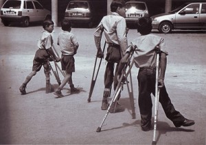 polio