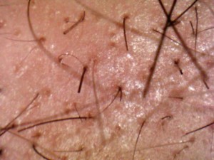 pubic hair