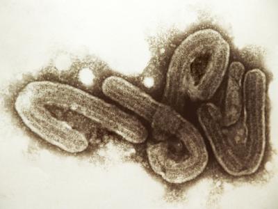 Ebola Liver Infection