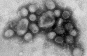 Swine Flu