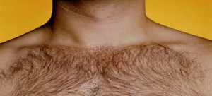 Excess-body-hair