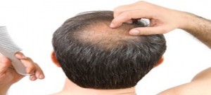 Ignoring-thinning-hair