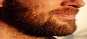 Too-much-facial-hair