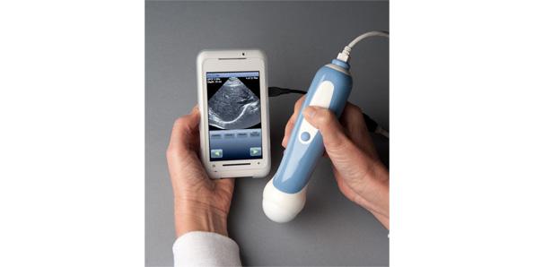 MobiUS ultrasound system