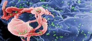 HIV_AIDS-300x136.jpg